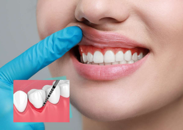 Why Patients Search for Periodontists Near Me for Treatment