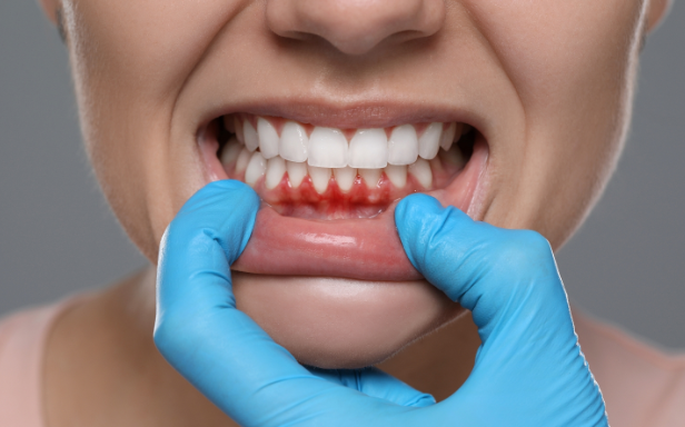 What Sets Experienced Periodontists Apart in Dental Care
