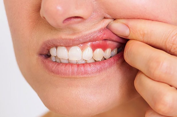 Finding an NYC Periodontist for Personalized Treatment