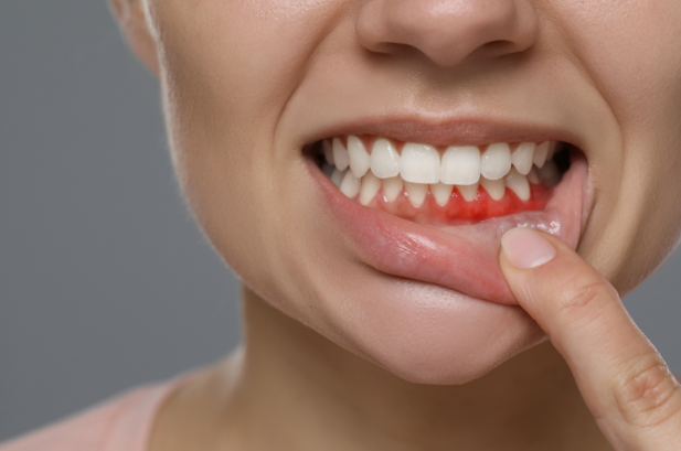 What to Expect From the Best Periodontist NYC Has to Offer