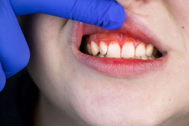 Benefits of Visiting a Cosmetic Periodontist Midtown NYC