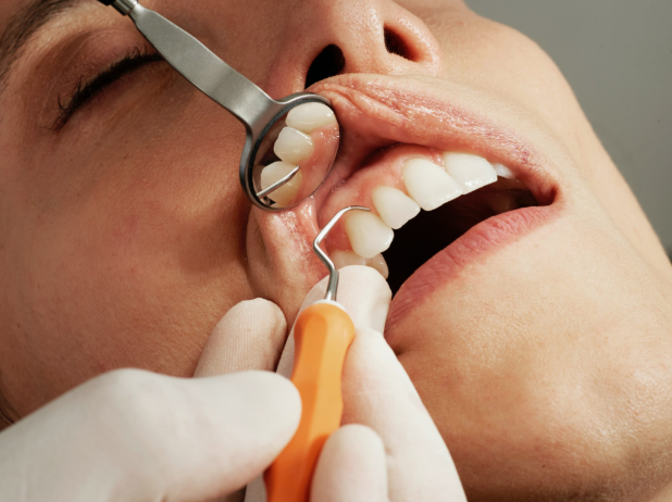 Periodontist Meaning Explained for Better Oral Health