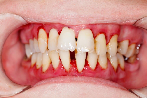 What Is a Periodontist and When Should You Visit One