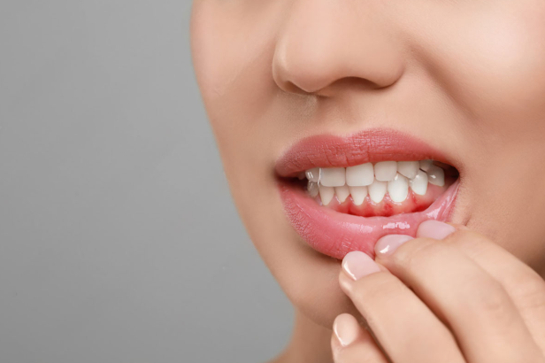 How to Find a Dental Implants Periodontist Near Me