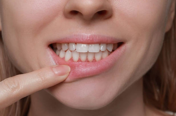 Benefits of Choosing a Periodontist Dental Implants Expert