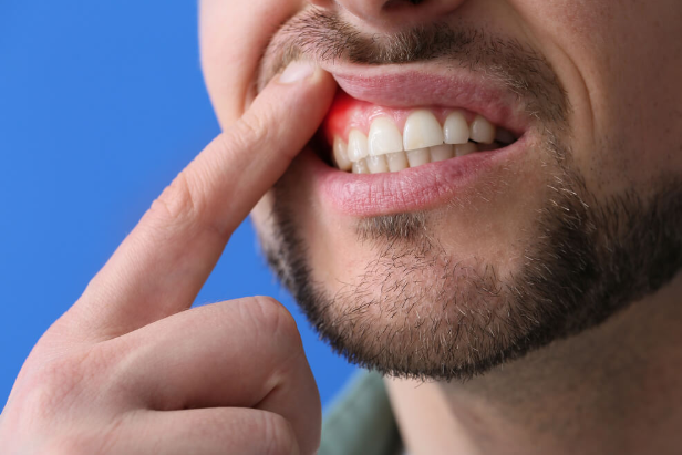 Why a Dental Implants Periodontist Improves Treatment Success